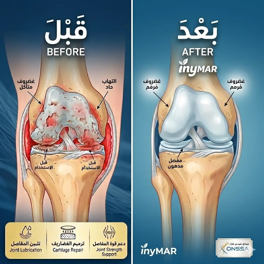 تأثير الكولاجين البحري على البشرة والمفاصل قبل وبعد